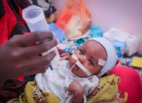 الصحة العالمية 46 بالمائة من أطفال اليمن يعانون التقزم