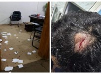 عصابة مسلحة تعتدي بالضرب على أحد المحامين في صنعاء