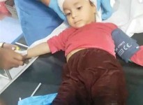 إصابة 3 أطفال بانفجار مقذوف من مخلفات ميليشيا الحوثي بمنطقة حجر شمال الضالع