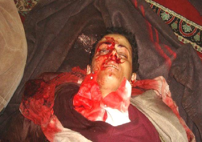 سياسيون وحقوقيون عرب: ما حدث من مجزرة مرعبة في اليمن بداية النهاية الحقيقية للنظام 