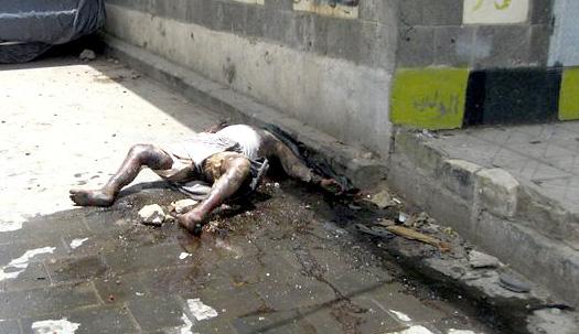 هود تناشد منظمات الإغاثة انتشال جثث متحللة في الحصبة بصنعاء