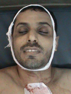  استشهاد الدكتور/ السعدي برصاص أمن عدن أثناء مشاركته في تشيع الشهيد درويش 