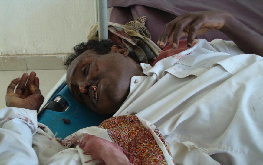  العثور على جثة مواطن صومالي مقتولاً بالقرب من موقع القطاع العسكري بالحبيلين
