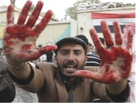  مسيرتان في البيضاء تنددان بقتل المتظاهرين في صنعاء