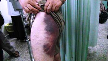 مليشيات الحوثي تختطف 4 أئمة مساجد في ساقين وحيدان وتعذبهم بوحشية