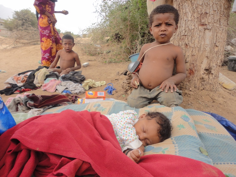 برنامج الأغذية العالمي: اليمن أعلى دول العالم الثالث في سوء التغذية بين الأطفال 