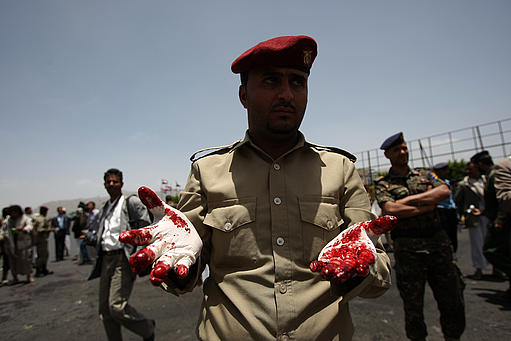 96 قتيلاً و300 جريحاً ضحايا الهجوم الانتحاري بصنعاء(صور)