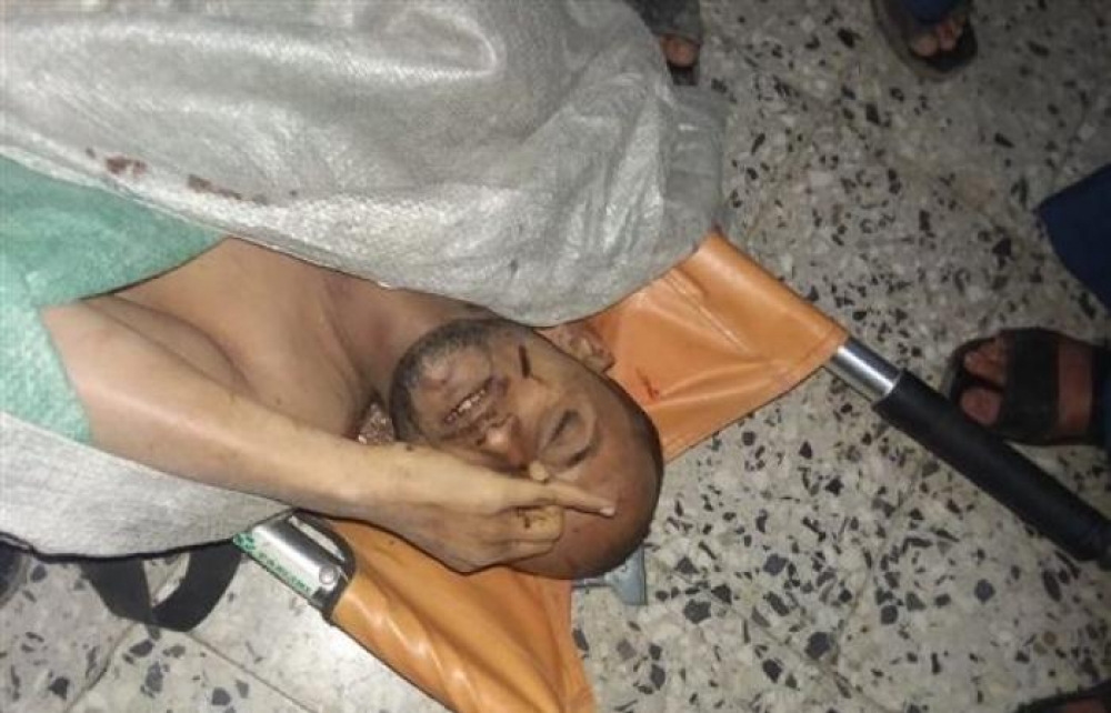 صنعاء.. مقتل مواطن داخل مسجد والتمثيل بجثته 