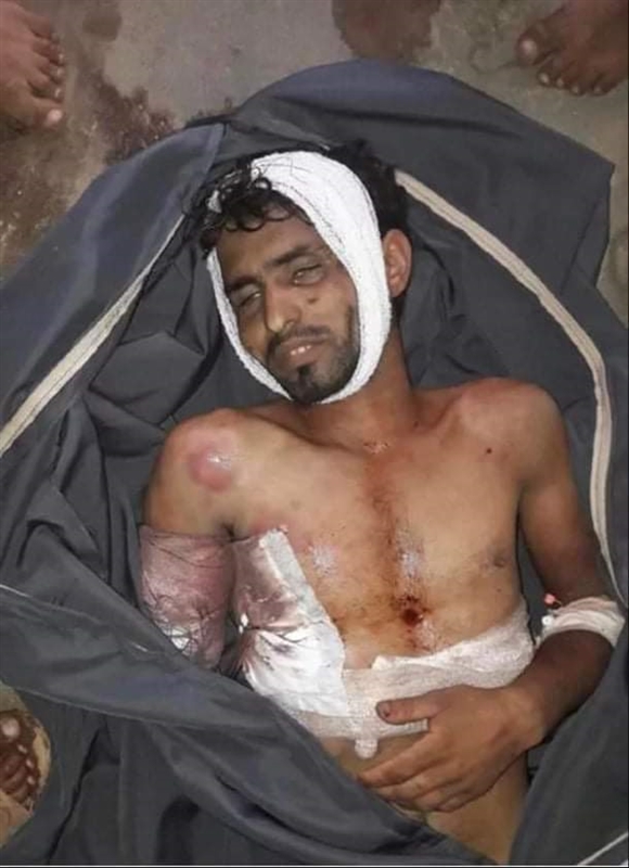 وفاة شاب تحت التعذيب في سجون الحوثيين بتعز