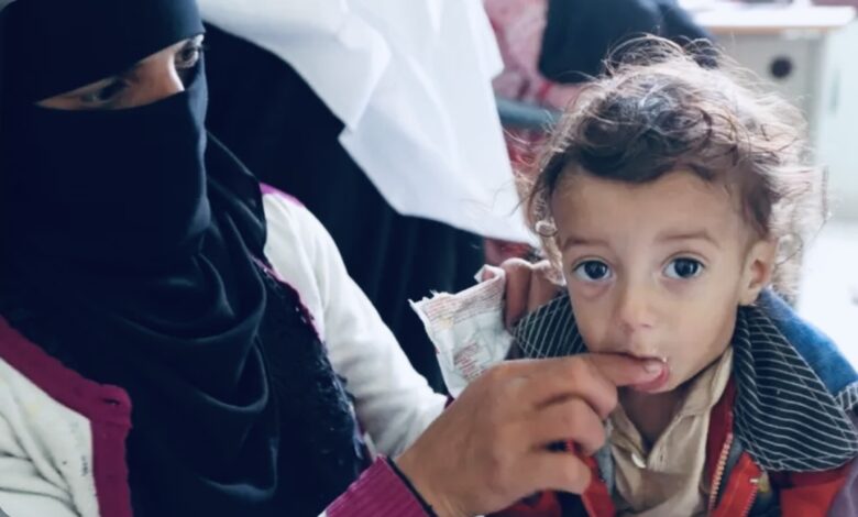 4,8 مليون دولار دعم أمريكي لمواجهة سوء التغذية لدى أطفال اليمن