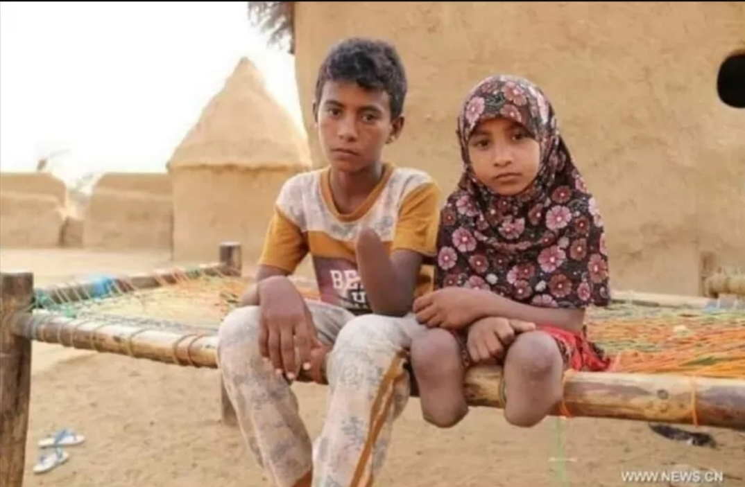 محافظ الحديدة: معظم ضحايا الألغام التي زرعها الحوثيين جلهم من الأطفال والنساء وكبار السن في ظل صمت الأمم المتحدة