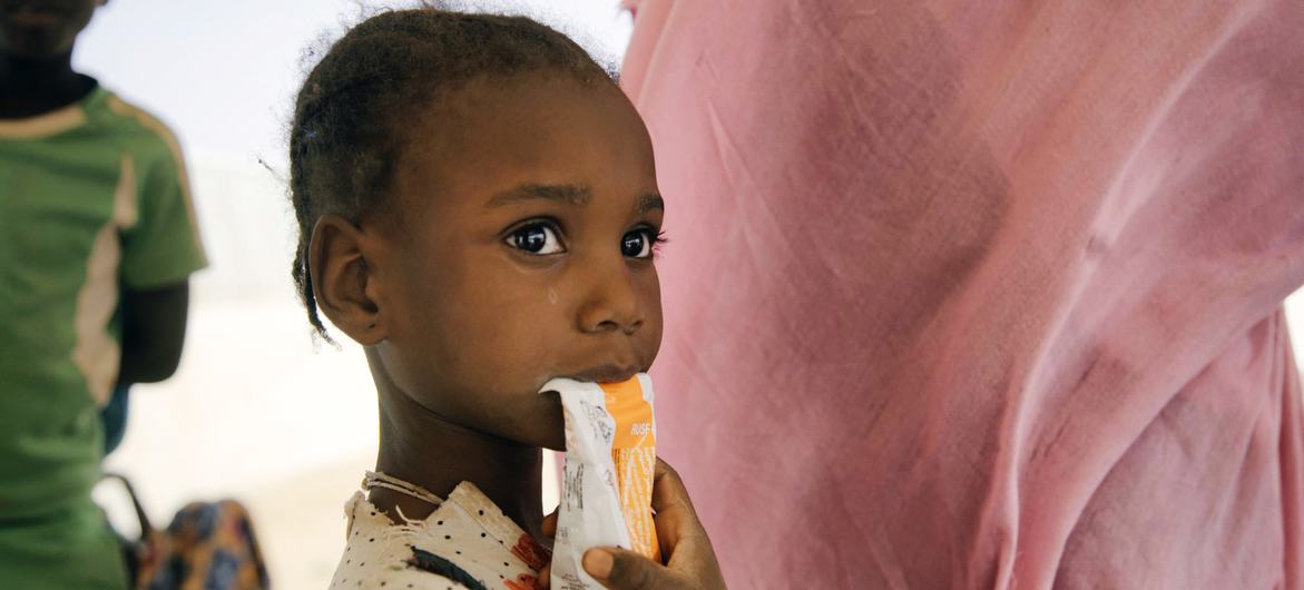 اليونيسيف: 5 ملايين طفل يعانون الهزال و10 ملايين دون الخامسة من سوء التغذية