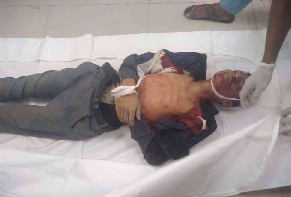 استشهاد شاب برصاصة قناص مليشيا الحوثي في تعز  