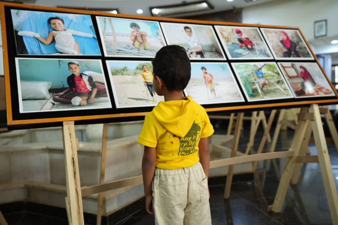 مأرب.. مشروع مسام ينظم معرضا بالصور يسلط الضوء على ضحايا الألغام المدنيين ومعاناتهم 