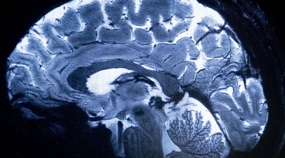 الصورة الأولى للدماغ البشري يلتقطها أقوى جهاز بالرنين المغناطيسي في العالم