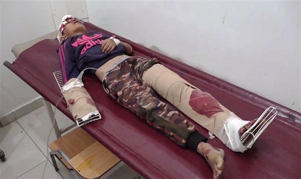 إصابة طفل بجروح خطيرة إثر قذيفة هاون أطلقتها ميليشيا الحوثي جنوبي تعز
