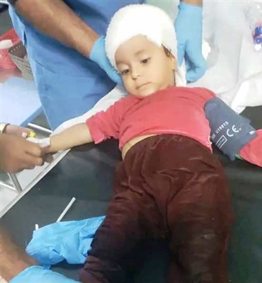 إصابة 3 أطفال بانفجار مقذوف من مخلفات ميليشيا الحوثي بمنطقة حجر شمال الضالع