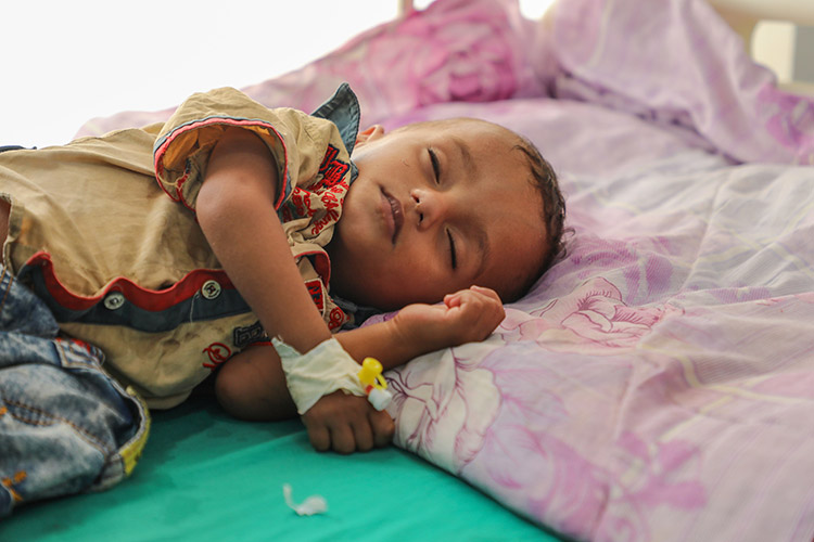 أمريكا تخصص 30 مليون دولار لعلاج نصف مليون طفل من سوء التغذية في اليمن