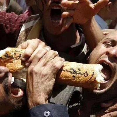 اليمن: سوء التغذية يدق جرس الإنذار 