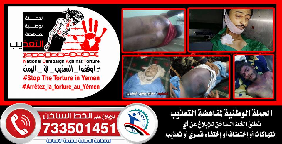 الموت تحت سياط التعذيب الحوثي